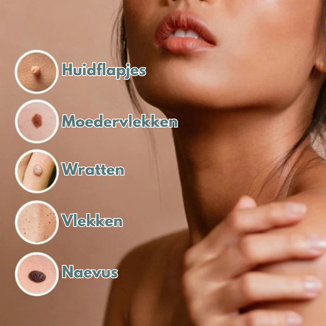 iBeaLee® - Huidtagverwijderaar