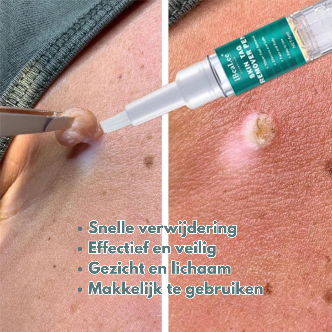 iBeaLee® - Huidtagverwijderaar